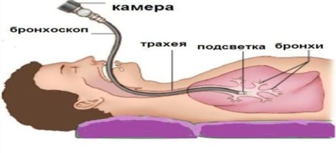 Астматический статус: причины, симптомы, первая помощь и лечение