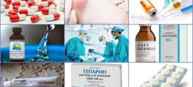 Постинъекционный флебит: лечение