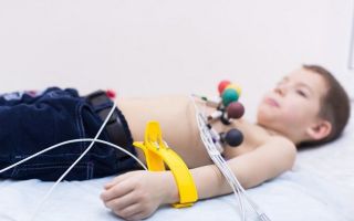 Синусовая аритмия у детей: причины и действия