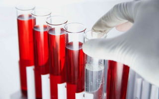 Как правильно сдать кровь на холестерин: правила подготовки и откуда берут анализ