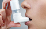 Причины, факторы риска развития астмы и основные триггеры