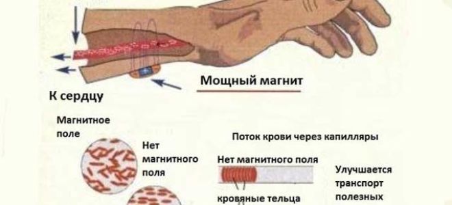 Алмаг при астме: принцип воздействия, эффективность, противопоказания