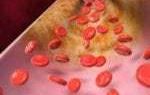 Цветы липы для снижения холестерина: отзывы, как принимать