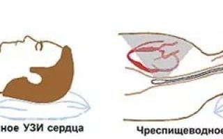 Обследование сердца и сосудов: все современные методики проверки состояния сердечно-сосудистой системы