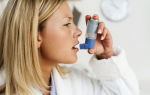 Купирование приступов бронхиальной астмы: методы и препараты