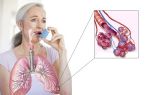 Бронхиальная астма и одышка: причины нарушений дыхания и лечение