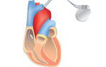Аритмии (нарушения сердечного ритма) – симптомы, виды и классификация, диагностика