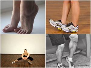 Упражнения при варикозе нижних конечностей: гимнастика, зарядка на работе, лечебная физкультура (ЛФК)