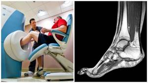МРТ сосудов нижних конечностей: что показывает и как проводится диагностика вен и артерий ног