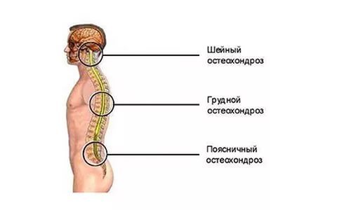 Атеросклероз сетчатки глаза: что это, лечение и профилактика