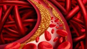Куркума от холестерина: как принимать для снижения уровня в крови, простые рецепты