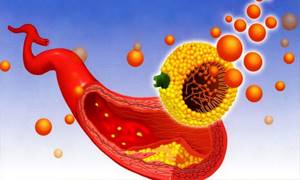 Гипотиреоз и холестерин: взаимосвязь щитовидной железы с высоким холестеролом