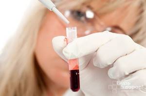 Хилез крови: что это такое, причины, симптомы и лечение липемии