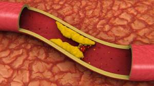 Обмен холестерина в организме человека: описание и нарушения метаболизма