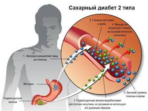 Тулип: инструкция по применению, цена, отзывы, аналоги лекарства