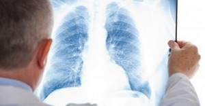 ХОБЛ и бронхиальная астма: дифференциальная диагностика