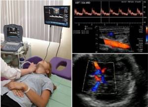 Дуплексное сканирование брахиоцефальных артерий (ДС БЦА шеи): что это за обследование, показания и оценка диагностики