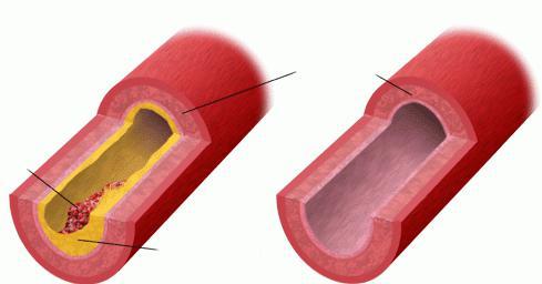 Дуплексное сканирование сосудов (вен и артерий) нижних конечностей: что это такое, показания и оценка результатов обследования