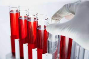 Как правильно сдать кровь на холестерин: правила подготовки и откуда берут анализ