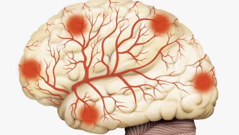 Как проверить сосуды головного мозга и шеи у взрослого – 8 современных методов диагностики