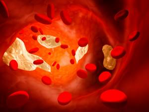 Алкоголь и холестерин в крови: связь и влияние на повышенный холестерол