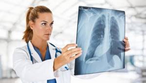 Рентген при бронхиальной астме: виды исследования и результаты