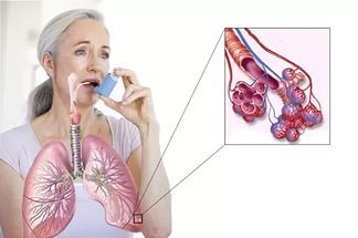 Особенности диспансеризации при бронхиальной астме у детей и взрослых