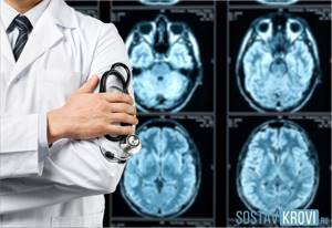 Какой врач лечит атеросклероз сосудов головного мозга и нижних конечностей