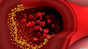 Хороший и плохой холестерин в анализе крови (ЛПВП и ЛПНП): что это такое, нормы полезных и вредных липопротеинов