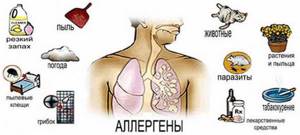 Аллергическая астма: механизм развития, причины, симптомы, лечение