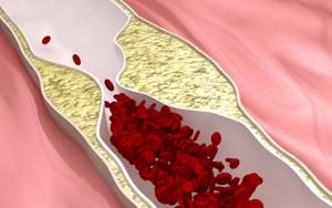 Анализ крови на холестерин: как обозначается латинскими буквами, расшифровка показателей и правила подготовки и сдачи