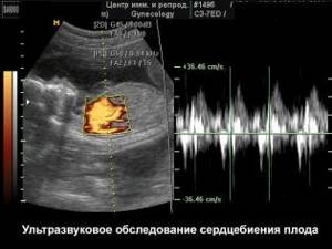 Сердцебиение плода по неделям: на каком сроке и когда можно услышать