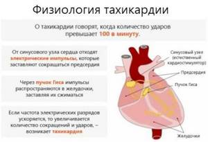 Таблетки и другие лекарства от тахикардии: что принимать при учащенном сердцебиении