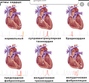 Признаки и симптомы проблем с сердцем
