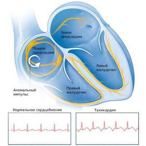 Нарушения пульса и сердцебиения