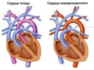 Сердцебиение плода по неделям: на каком сроке и когда можно услышать