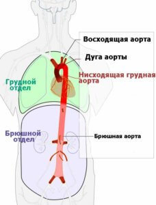 Что такое аорта и где она находится – диаметр и расположение в норме и при патологии